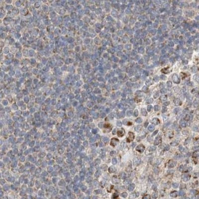 RNMTL1 Antibody in Immunohistochemistry (IHC)