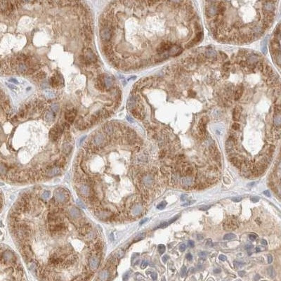 RNMTL1 Antibody in Immunohistochemistry (IHC)