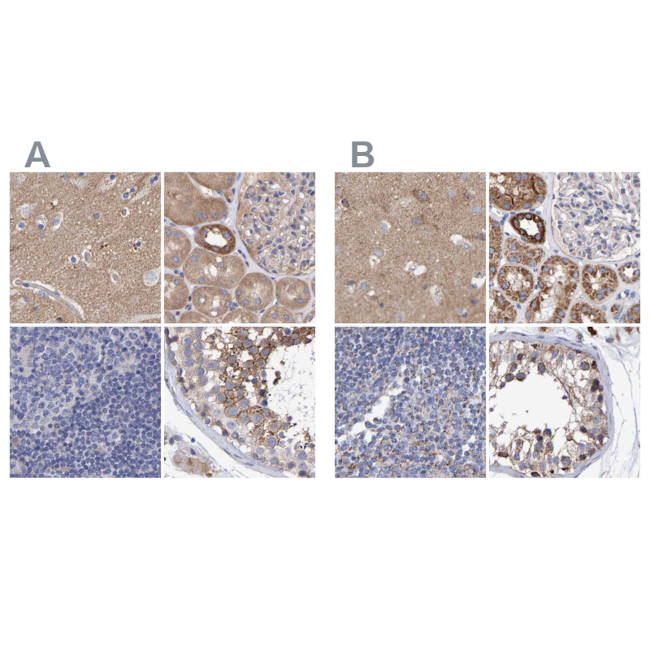 EFR3A Antibody in Immunohistochemistry (IHC)