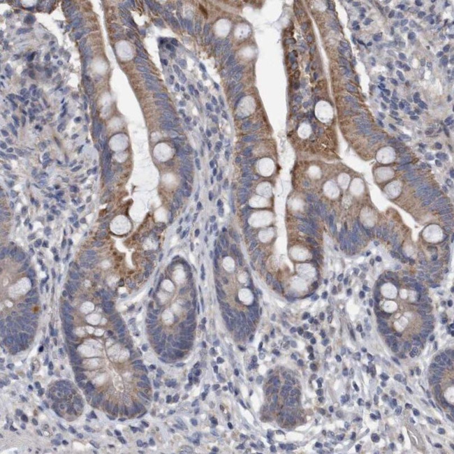 DDHD2 Antibody in Immunohistochemistry (IHC)