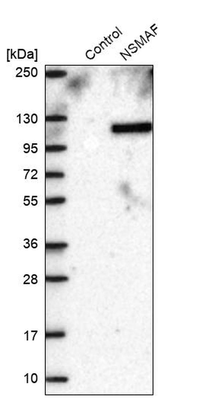 FAN Antibody in Western Blot (WB)