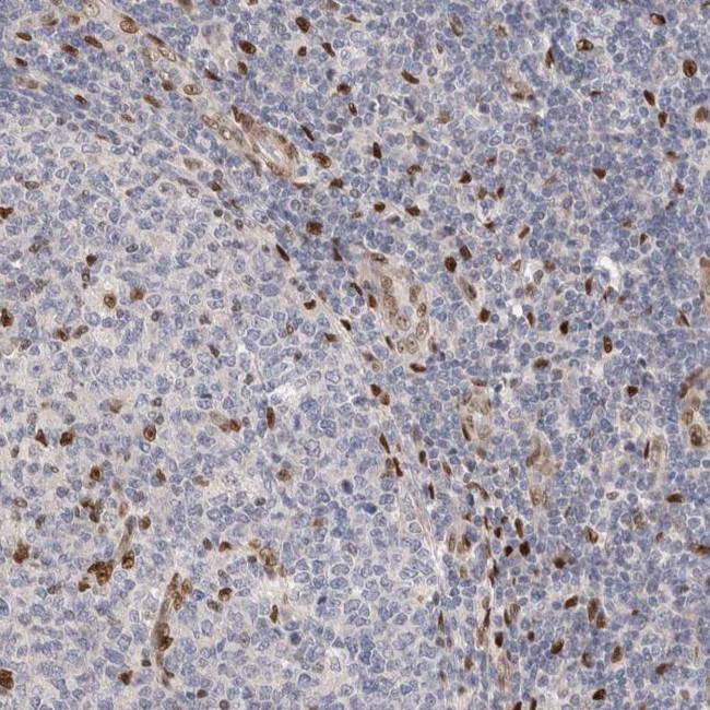 FAN Antibody in Immunohistochemistry (IHC)