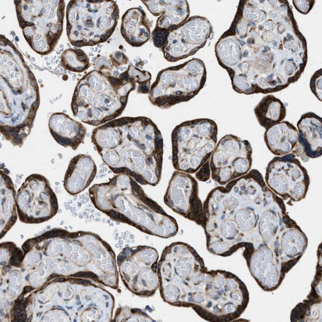 SLC38A10 Antibody in Immunohistochemistry (IHC)