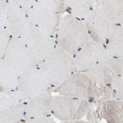 SLC38A10 Antibody in Immunohistochemistry (IHC)