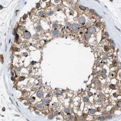 SLC38A10 Antibody in Immunohistochemistry (IHC)