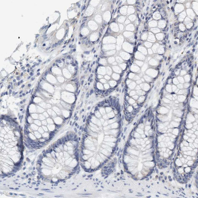 VSIG8 Antibody in Immunohistochemistry (IHC)