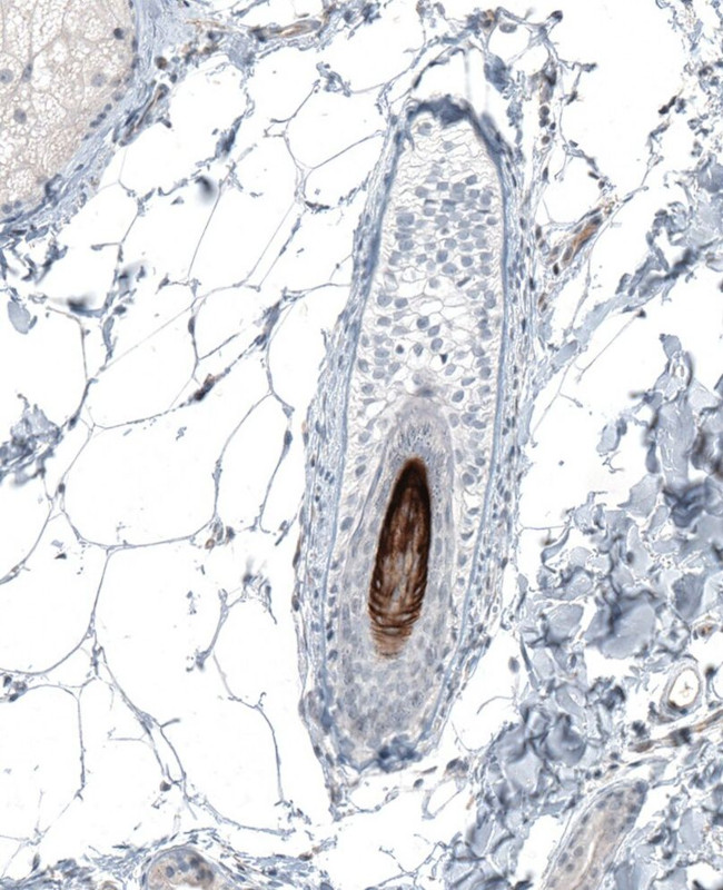 VSIG8 Antibody in Immunohistochemistry (IHC)