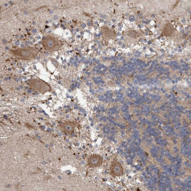 VSIG8 Antibody in Immunohistochemistry (IHC)