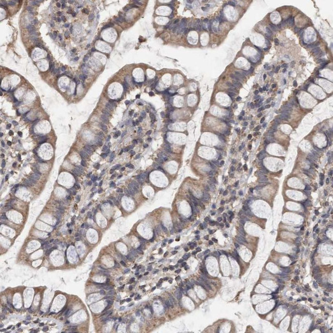 VSIG8 Antibody in Immunohistochemistry (IHC)