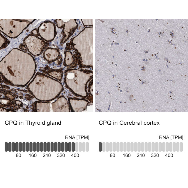 PGCP Antibody in Immunohistochemistry (IHC)