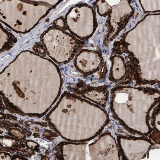 PGCP Antibody in Immunohistochemistry (IHC)