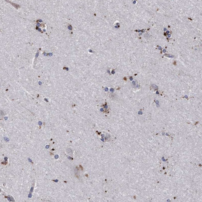 PGCP Antibody in Immunohistochemistry (IHC)