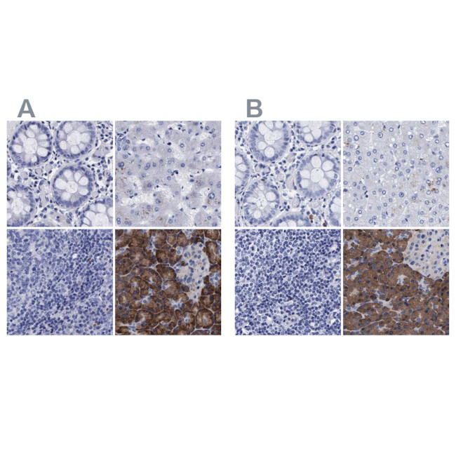 Arylsulfatase G Antibody in Immunohistochemistry (IHC)