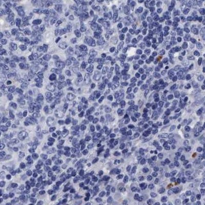 Arylsulfatase G Antibody in Immunohistochemistry (IHC)