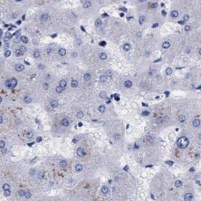 Arylsulfatase G Antibody in Immunohistochemistry (IHC)