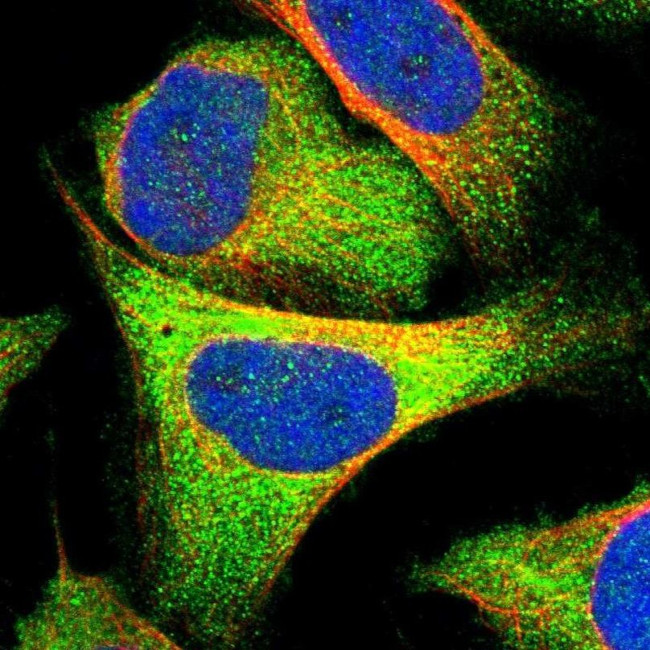 C17orf25 Antibody in Immunocytochemistry (ICC/IF)