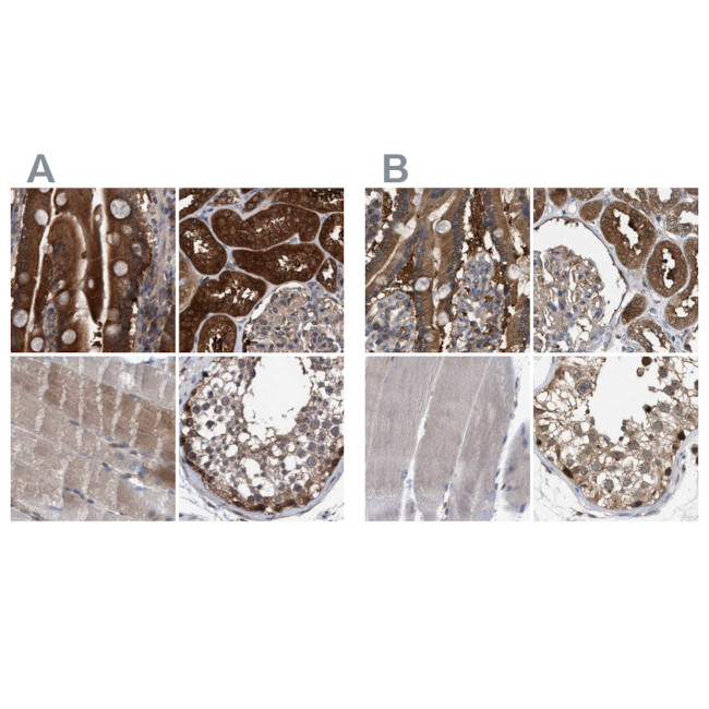 C17orf25 Antibody in Immunohistochemistry (IHC)