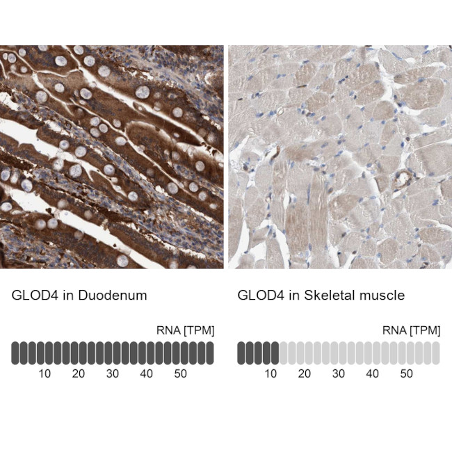 C17orf25 Antibody