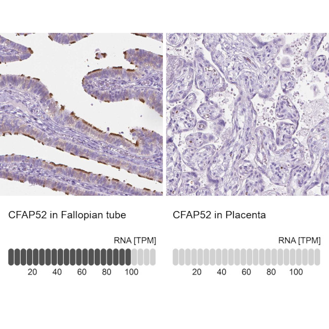 WDR16 Antibody in Immunohistochemistry (IHC)