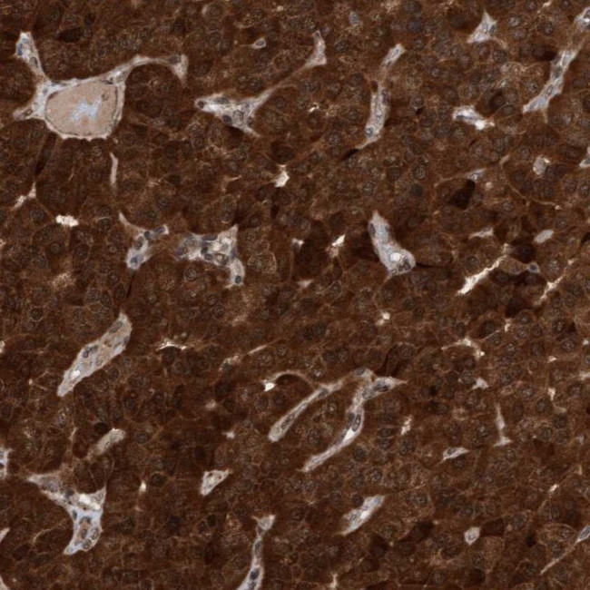 TANC2 Antibody in Immunohistochemistry (IHC)