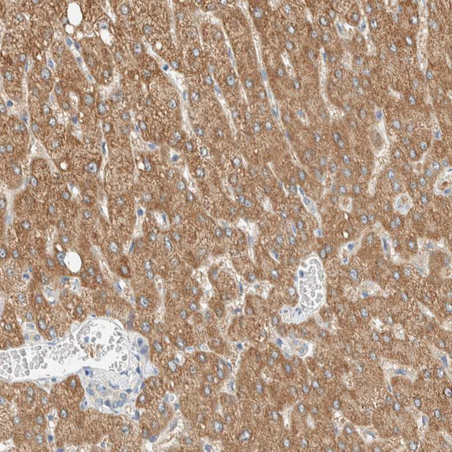 ALDH7A1 Antibody in Immunohistochemistry (IHC)