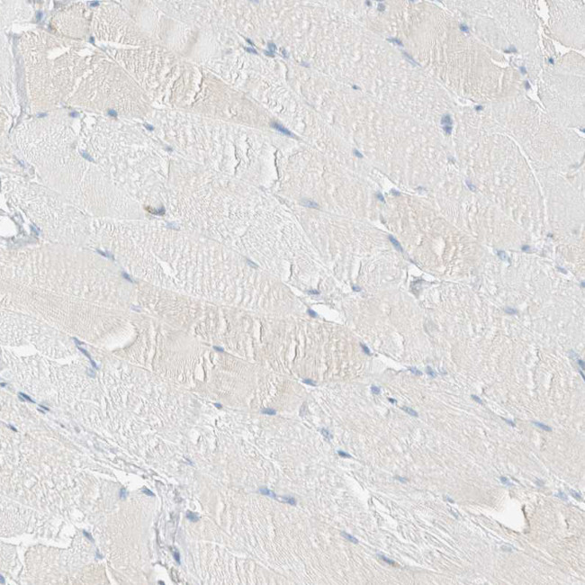 ALDH7A1 Antibody in Immunohistochemistry (IHC)