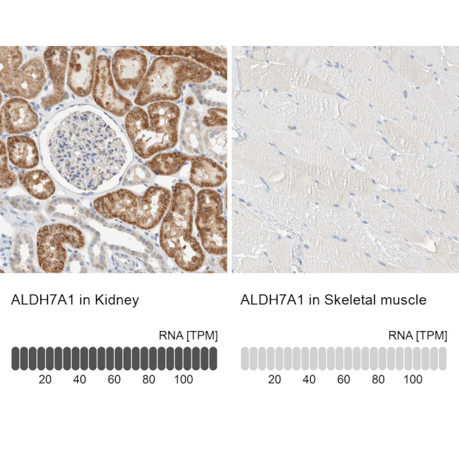 ALDH7A1 Antibody