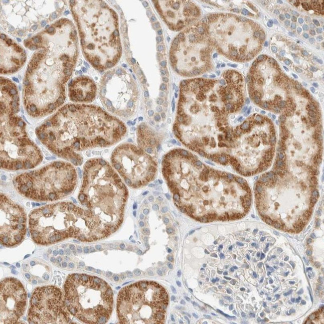 ALDH7A1 Antibody in Immunohistochemistry (IHC)