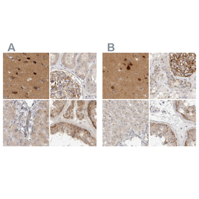 TOM1L2 Antibody in Immunohistochemistry (IHC)