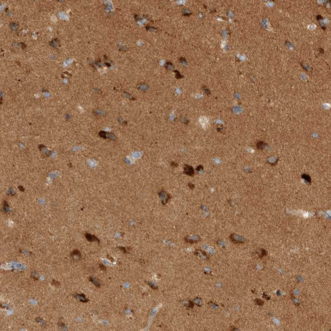 TOM1L2 Antibody in Immunohistochemistry (IHC)