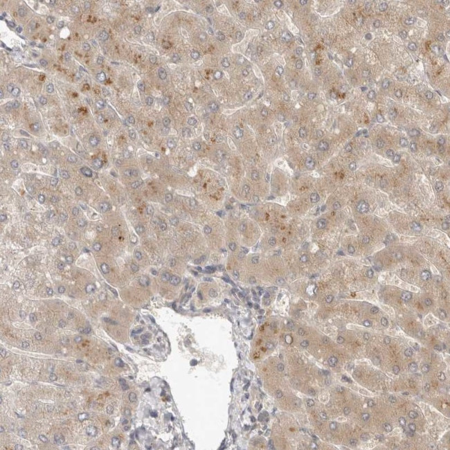 TOM1L2 Antibody in Immunohistochemistry (IHC)