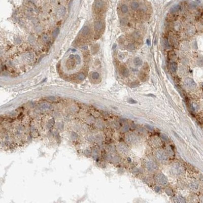 TOM1L2 Antibody in Immunohistochemistry (IHC)