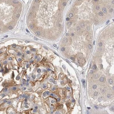 TOM1L2 Antibody in Immunohistochemistry (IHC)