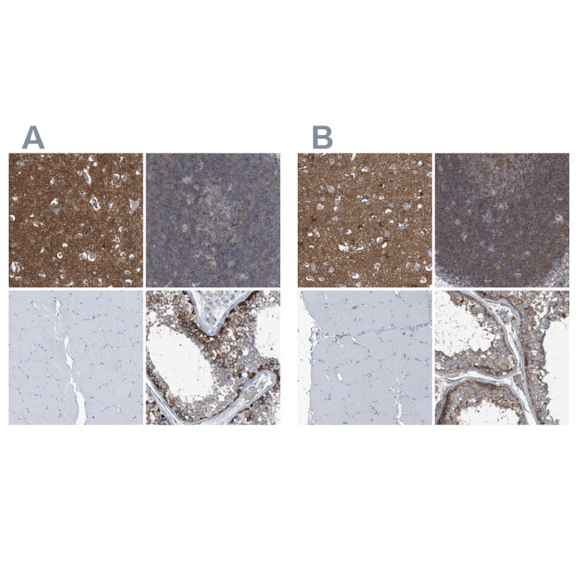 Septin-7 Antibody in Immunohistochemistry (IHC)