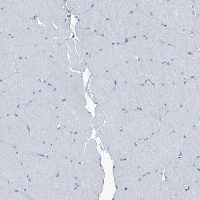 Septin-7 Antibody in Immunohistochemistry (IHC)