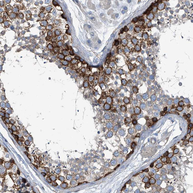 Septin-7 Antibody in Immunohistochemistry (IHC)