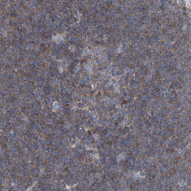 Septin-7 Antibody in Immunohistochemistry (IHC)