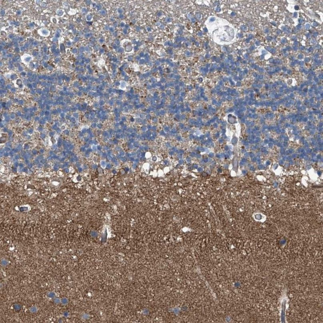 Septin-7 Antibody in Immunohistochemistry (IHC)