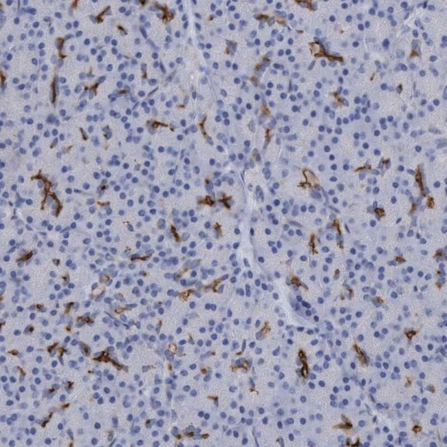 SLC28A3 Antibody in Immunohistochemistry (IHC)