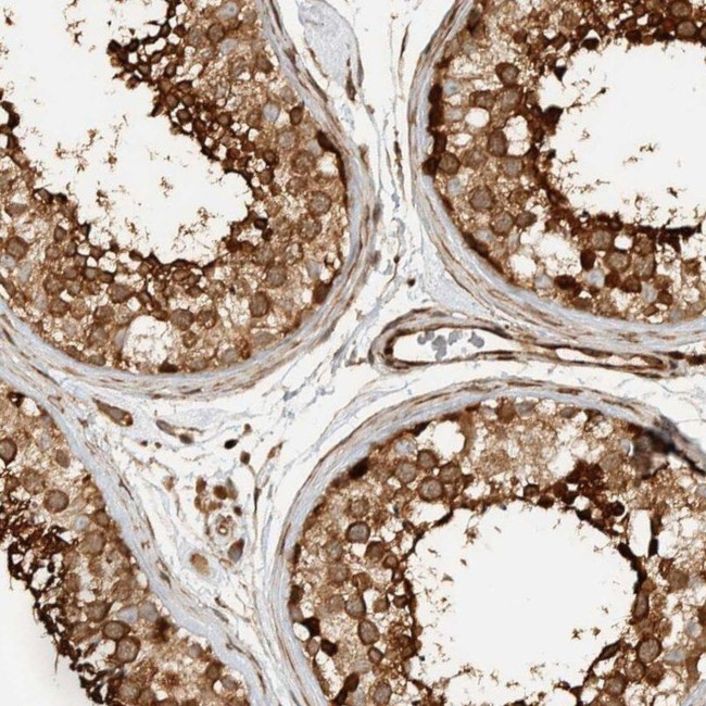 CNTROB Antibody in Immunohistochemistry (IHC)