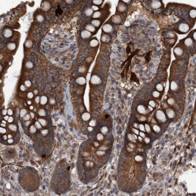 GGT6 Antibody in Immunohistochemistry (IHC)