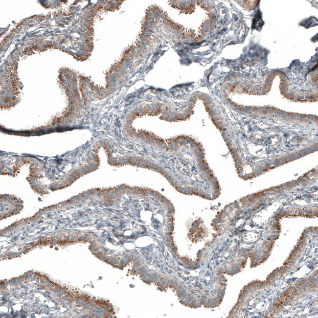 PCM1 Antibody in Immunohistochemistry (IHC)