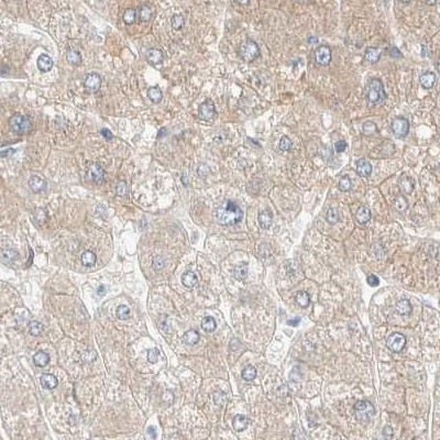 PCM1 Antibody in Immunohistochemistry (IHC)