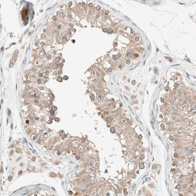 PCM1 Antibody in Immunohistochemistry (IHC)