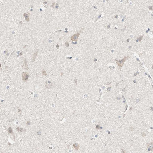 PCM1 Antibody in Immunohistochemistry (IHC)