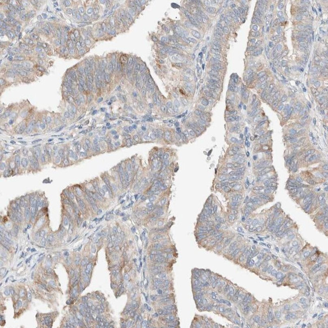 PCM1 Antibody in Immunohistochemistry (IHC)