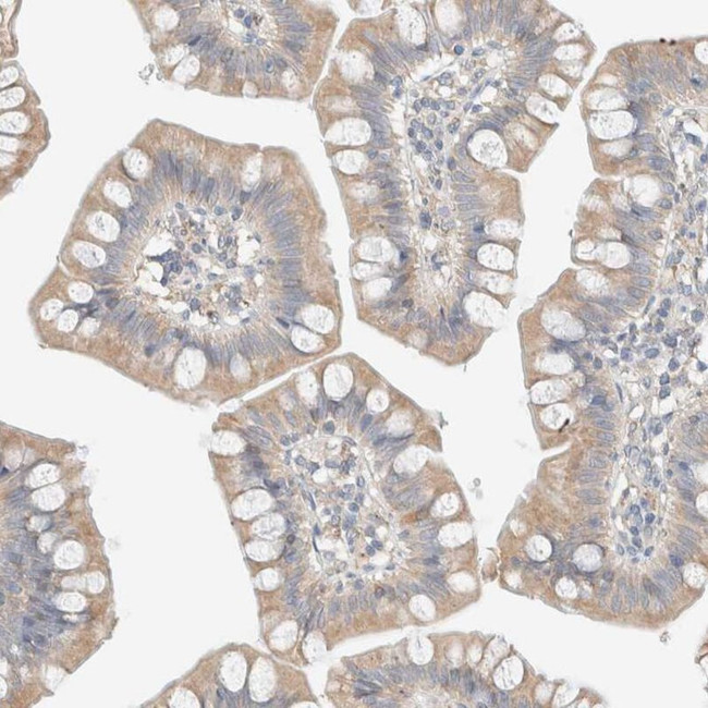 PCM1 Antibody in Immunohistochemistry (IHC)