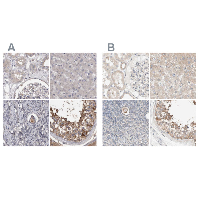 PCM1 Antibody