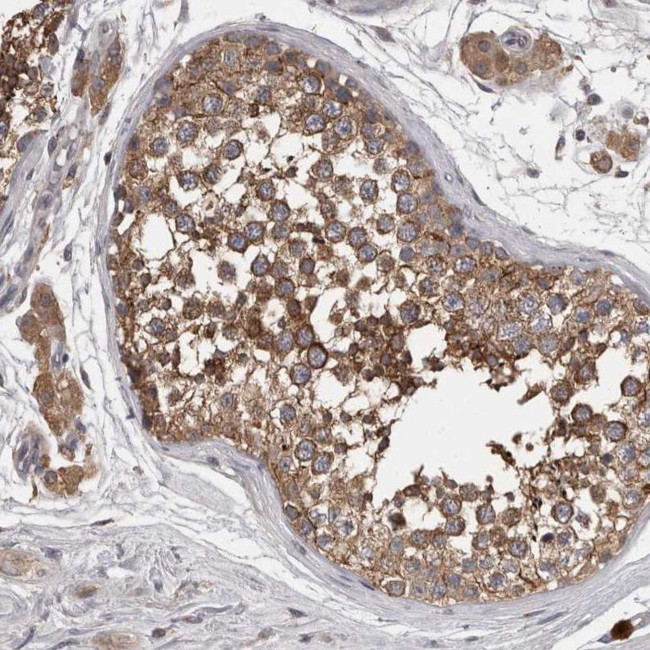 PCM1 Antibody in Immunohistochemistry (IHC)