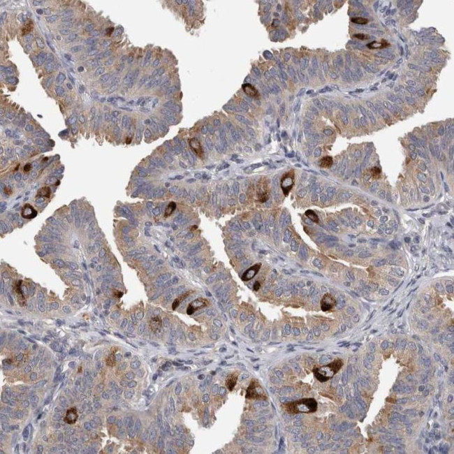 PCM1 Antibody in Immunohistochemistry (IHC)